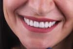 teeth whitening treatments