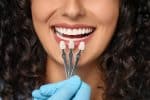 porcelain veneers